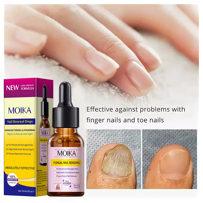 Sérum de traitement fongique des ongles, élimination des champignons des pieds, Gel de réparation, A