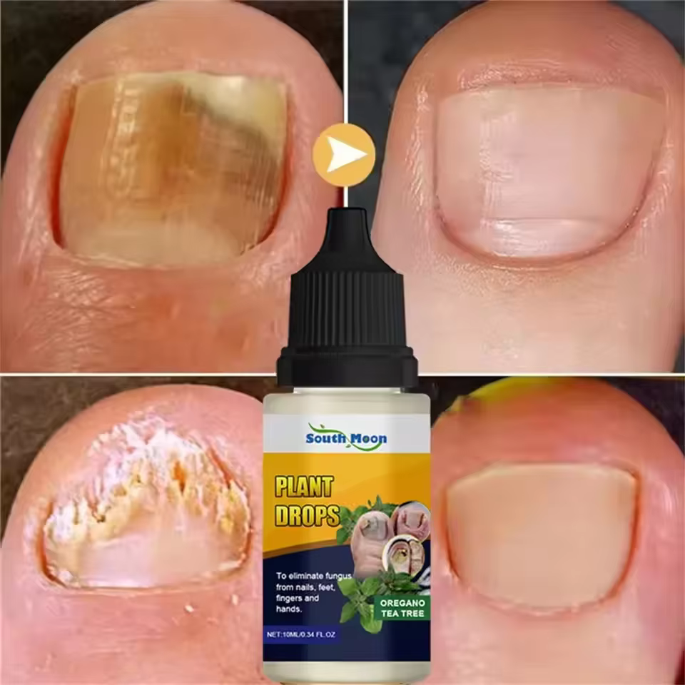 7 jours traitements fongiques des ongles sérum liquide Anti-Infection onychomycose Paronychia soin d