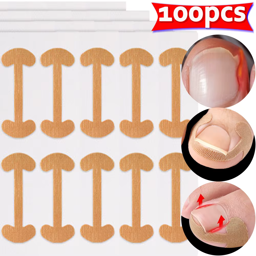 Bandes correctrices pour ongles incarnés, 100 pièces, adhérence durable, autocollants imperméables, 