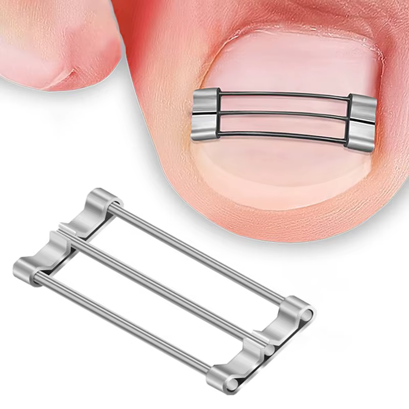 Correcteur d'ongles incarnés, outils de pédicure, récupération intégrée, traitement professionnel de