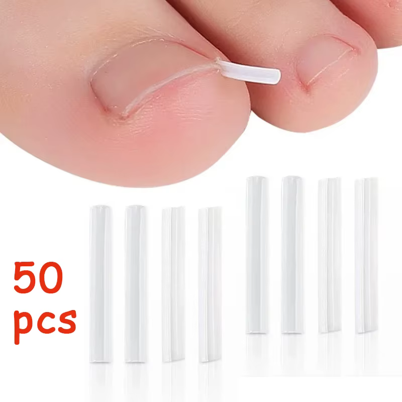 Outil de Correction des ongles incarnés, 50 pièces, tampon de traitement des ongles incarnés invisib