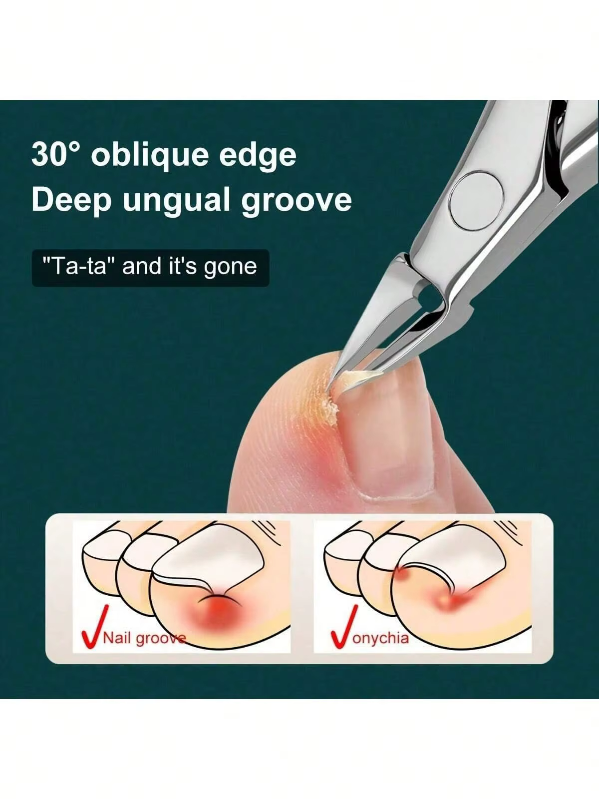 Coupe-ongles professionnel à bec d'aigle allemand – Coupe-ongles de précision pour ongles épais, idé