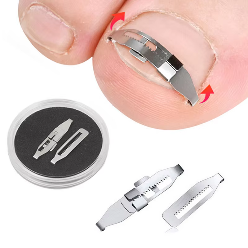 Correcteur d'ongles incarnés, outils de pédicure, récupération intégrée, traitement des ongles des o