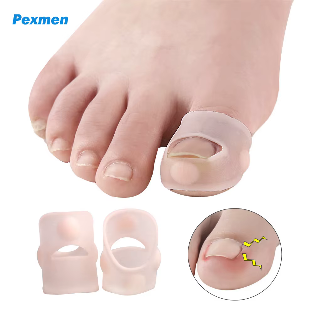 Pexmen 2/4/10 pièces Gel correcteur d'ongle incarné manches gros orteil ongles guérison soins protec