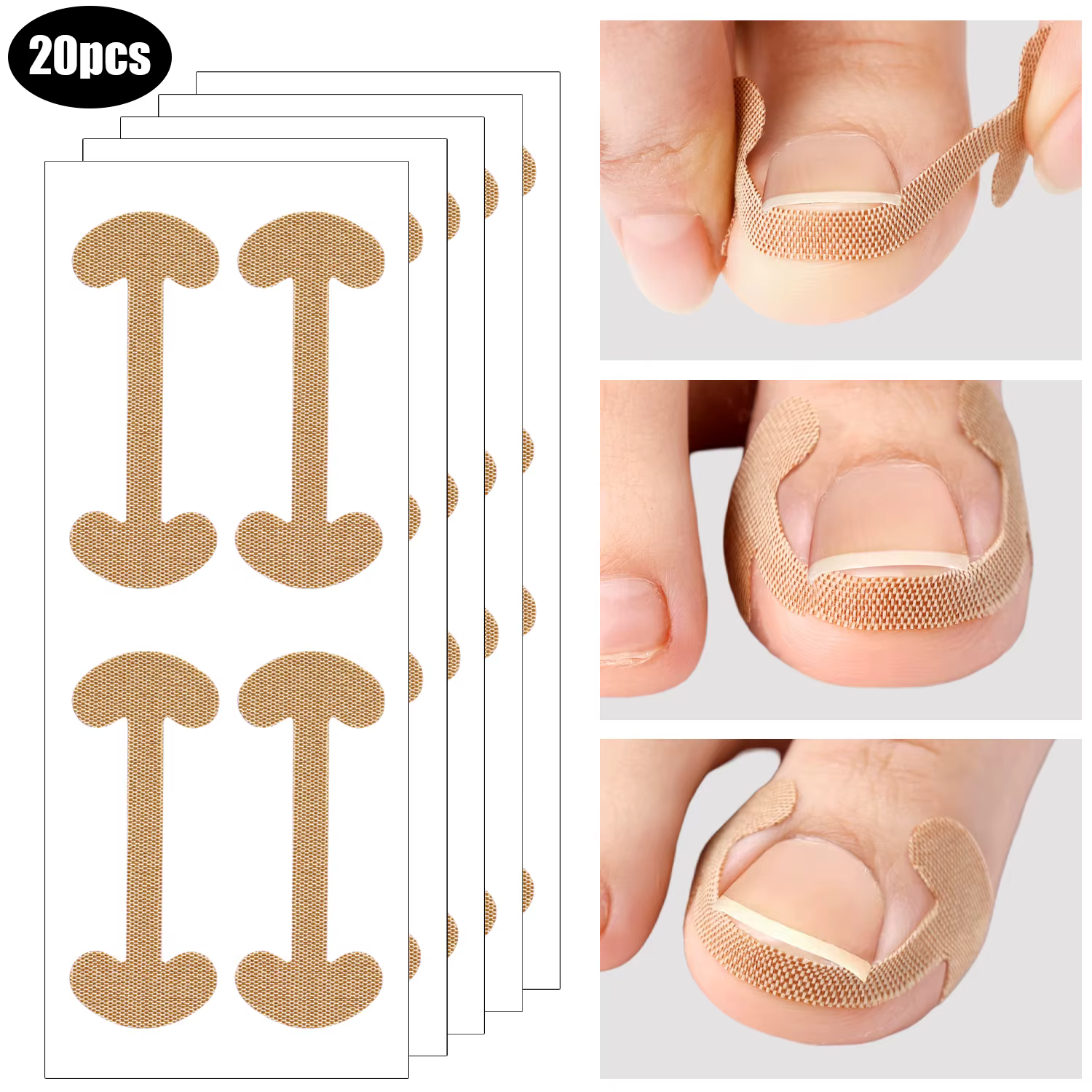 Bandes correctrices pour ongles incarnés, 100 pièces, adhérence durable, autocollants imperméables, 