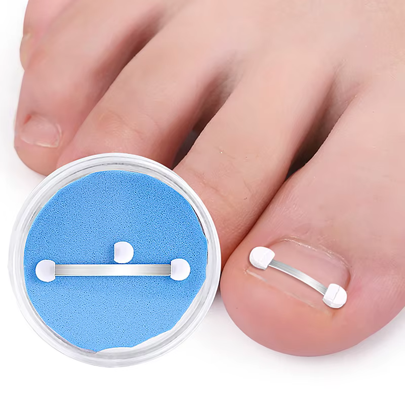 Correcteur d'ongles incarnés, outils de pédicure, récupération intégrée, traitement des ongles des o