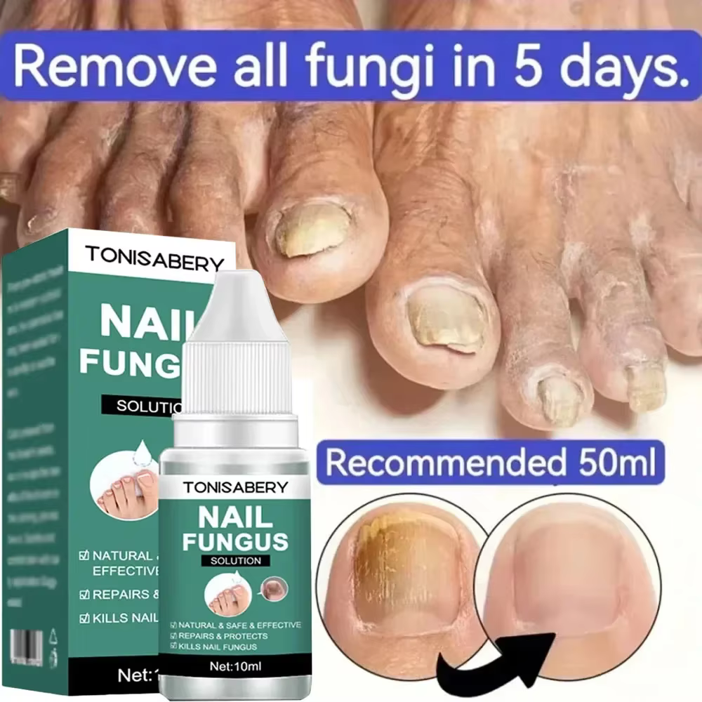 Sérum de traitement des champignons des ongles, liquide de réparation des pieds, Gel d'élimination d