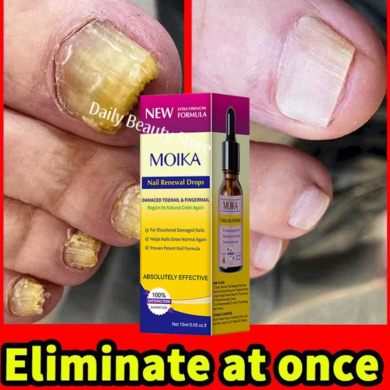 Sérum de traitement fongique des ongles, élimination des champignons des pieds, Gel de réparation, A