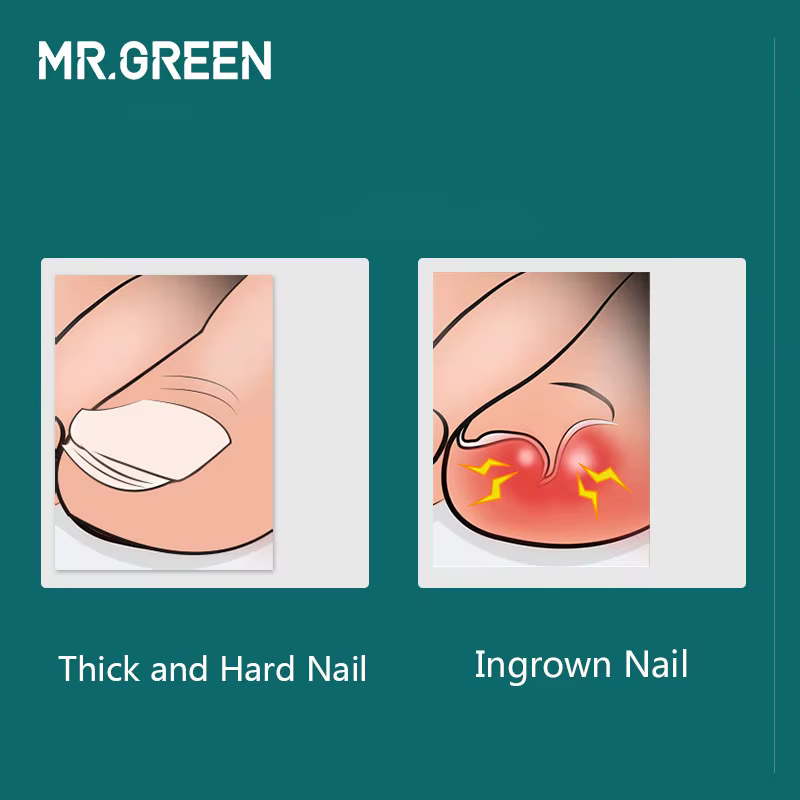 MR.GREEN – outils de manucure professionnels