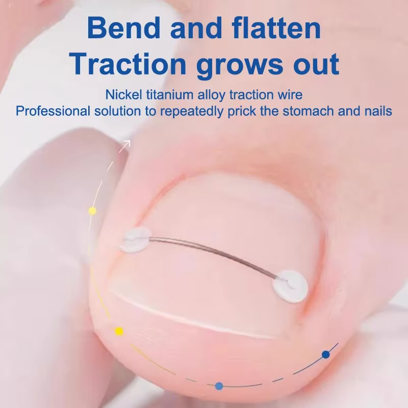 Soins des ongles outil de Correction