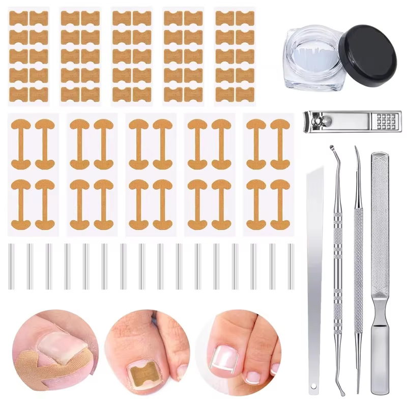Ensemble de Correction des ongles incarnés