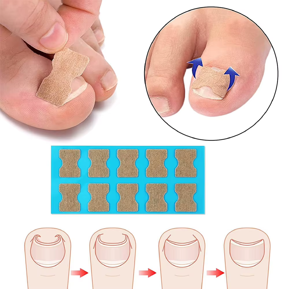 Patch autocollant pour traitement des ongles incarnés