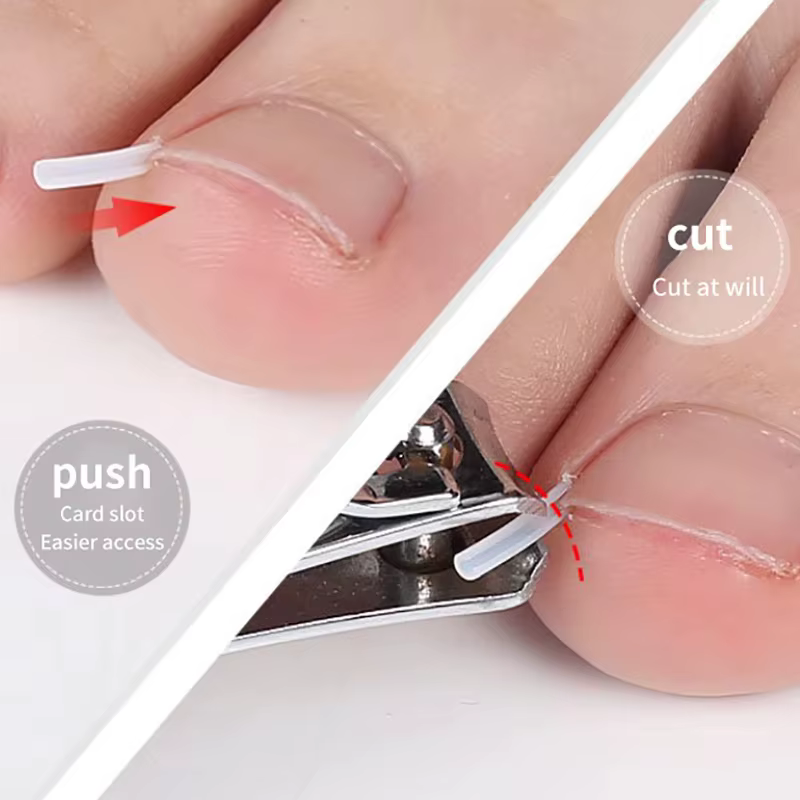 Outil de Correction des ongles incarnés