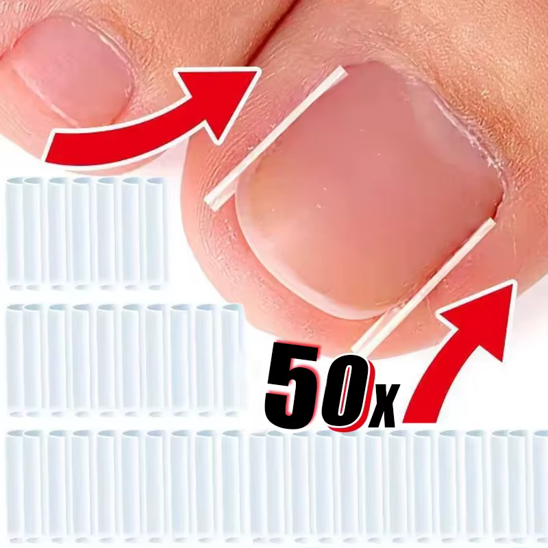 Outil de Correction des ongles incarnés