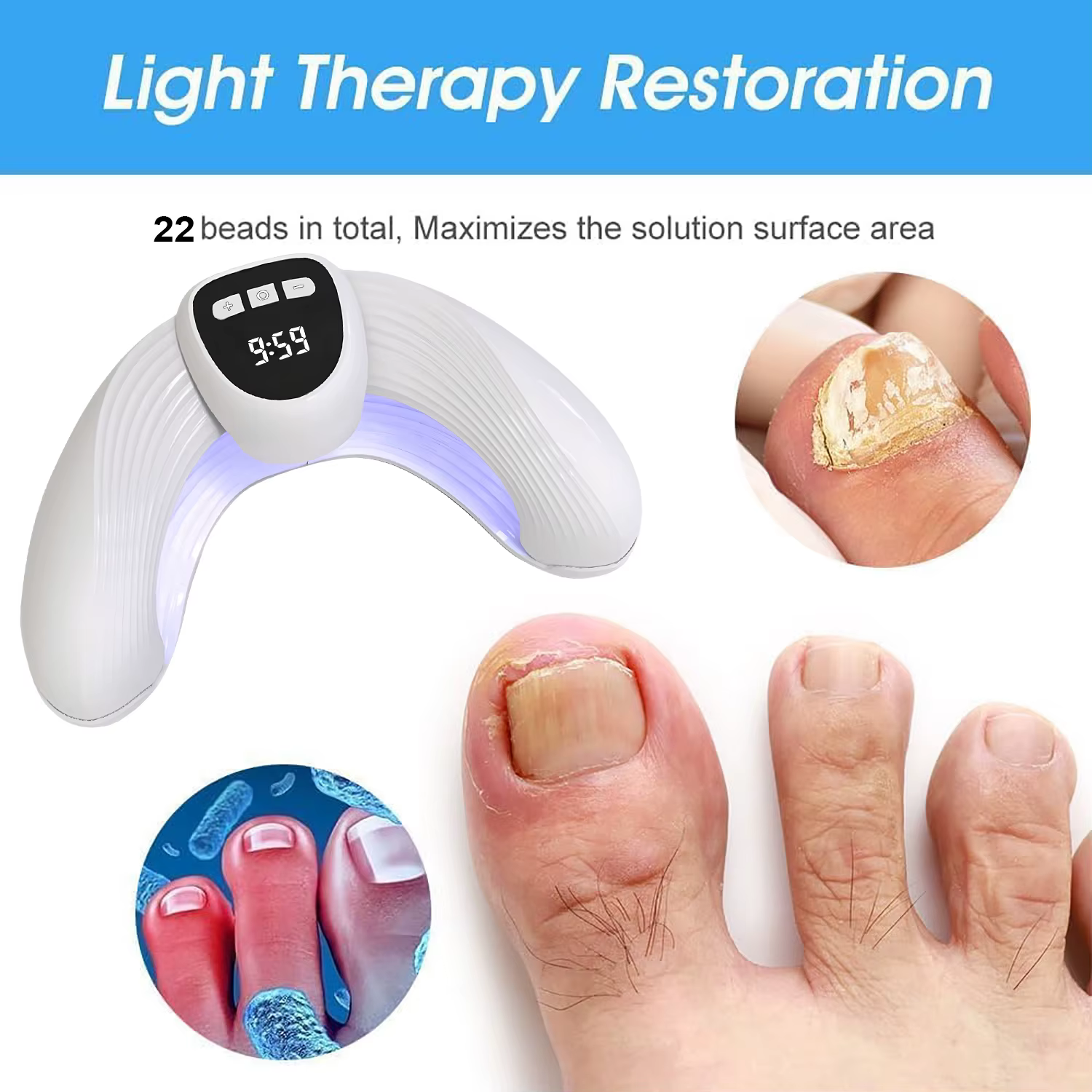 Dispositif laser de traitement des champignons des ongles – Élimine