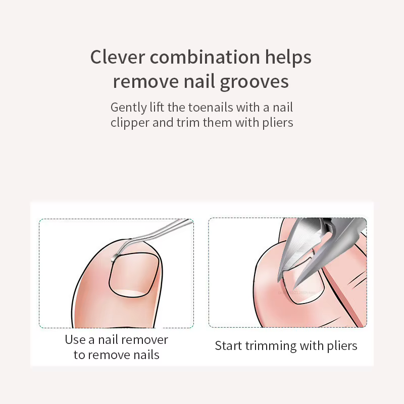 Coupe-ongles pour pédicure et manucure