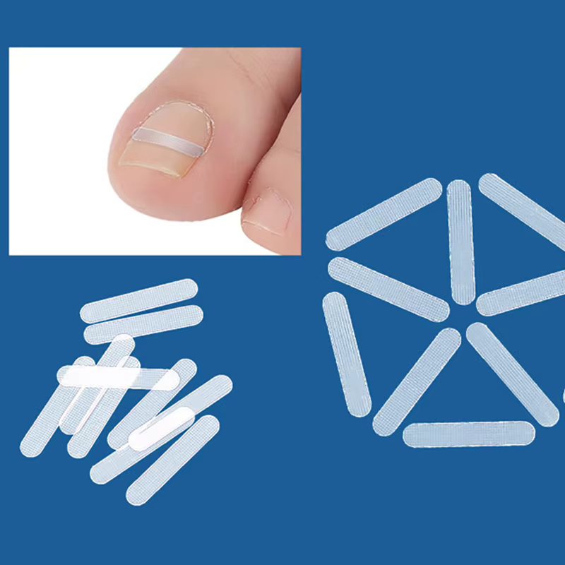 Traitement des ongles incarnés