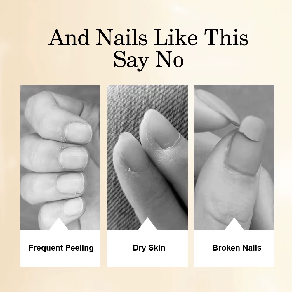 Stylo à huile pour la Nutrition des ongles