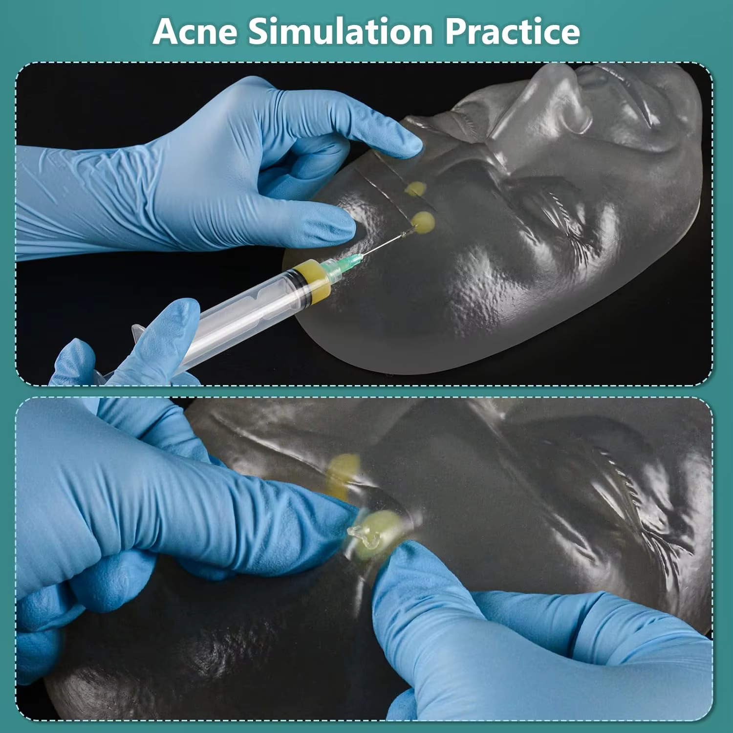 Modèle de tête Ultrassist pour injection faciale et lifting par fils, modèle d'entraînement à l'injection pour esthéticiennes et médecins