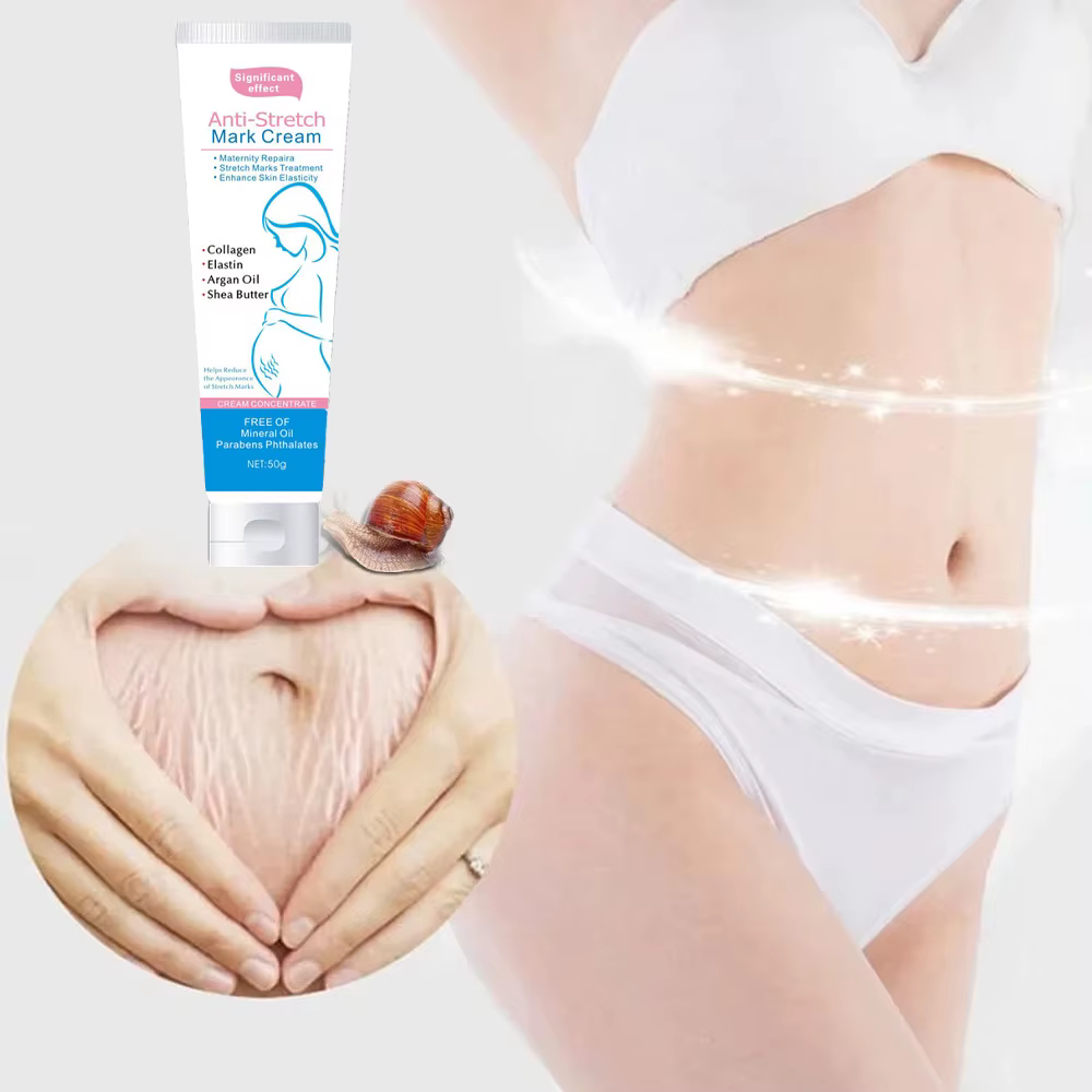 L'escargot élimine les vergetures crème pour éliminer l'obésité post-partum femmes enceintes réparation Anti-âge Anti-rides crème raffermissante pour le corps