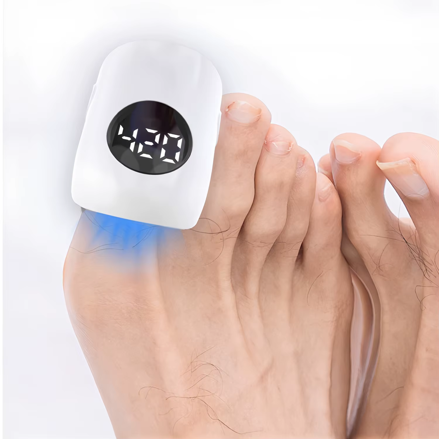 Lampe de photothérapie laser efficace pour l'élimination des mycoses des ongles