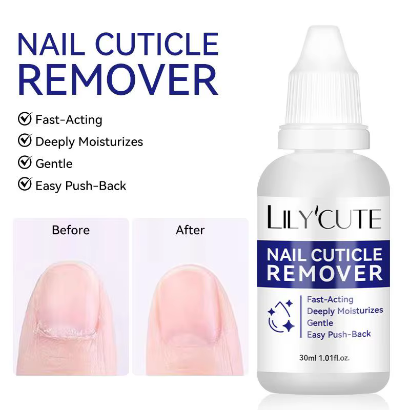 Gel dissolvant de cuticules 30 ml pour ongles