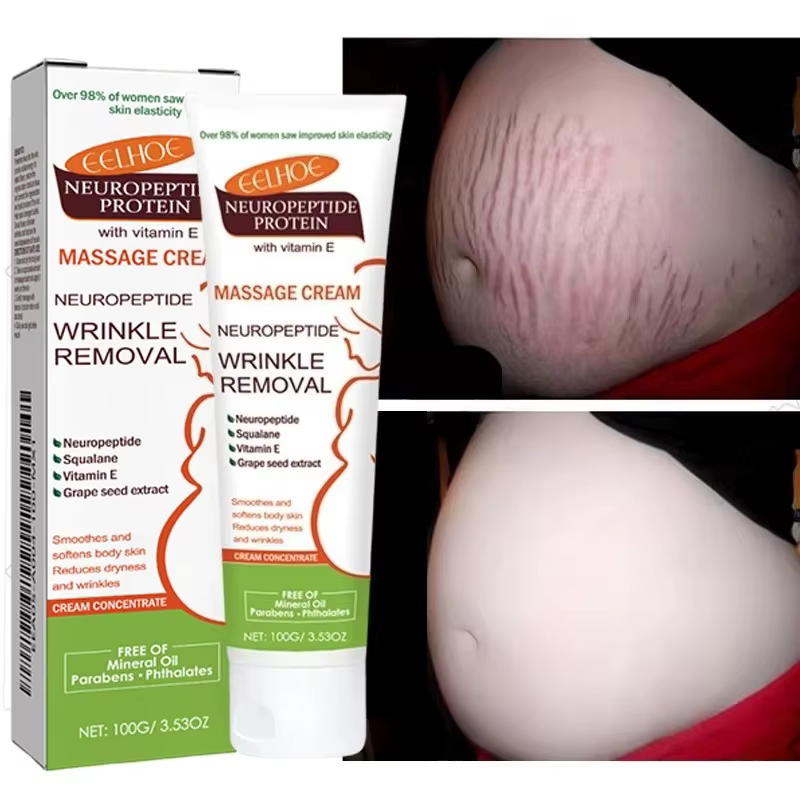Crème anti-vergetures permanente 100g pour femmes enceintes, soin corporel lissant, réparateur et raffermissant pour la peau