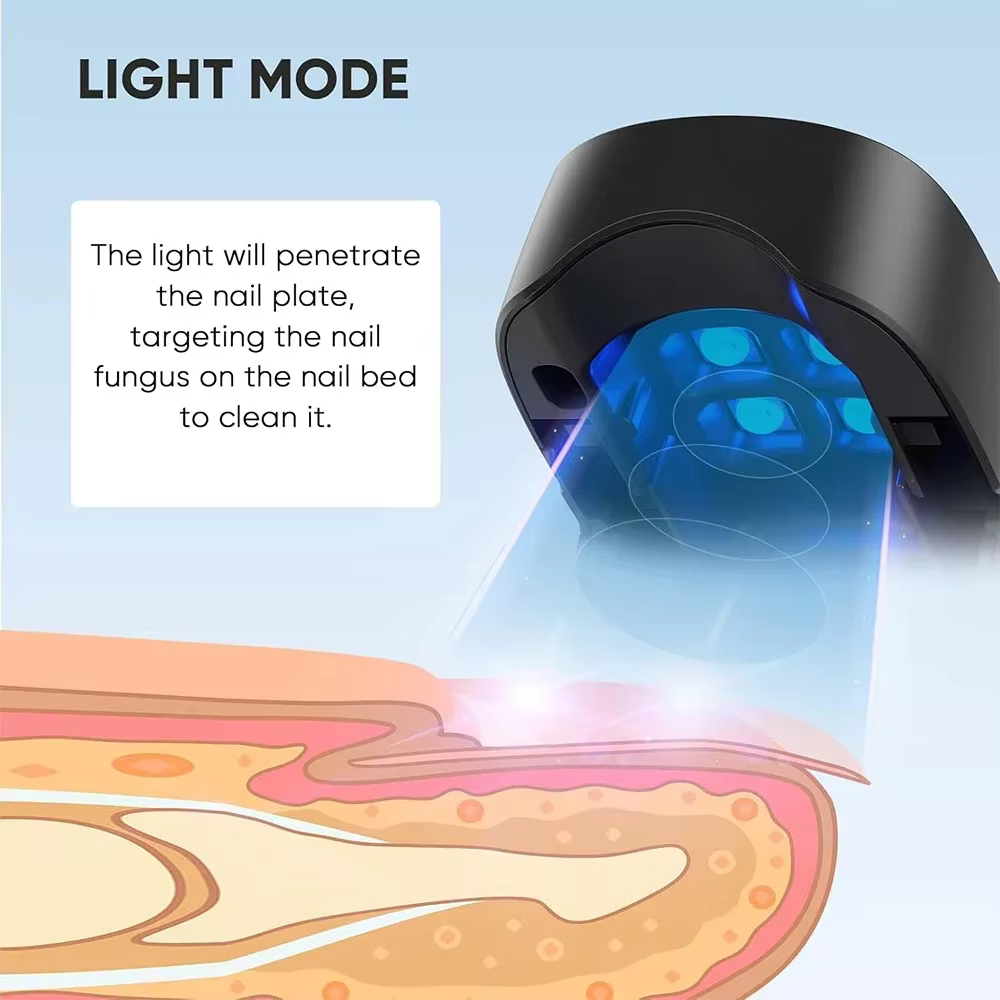 Appareil laser LED pour le traitement des mycoses des ongles