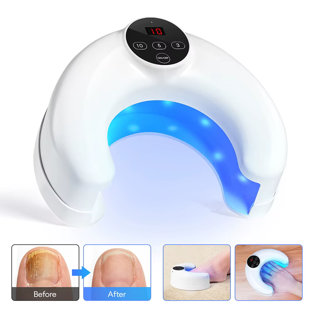 Appareil laser pour le traitement des ongles