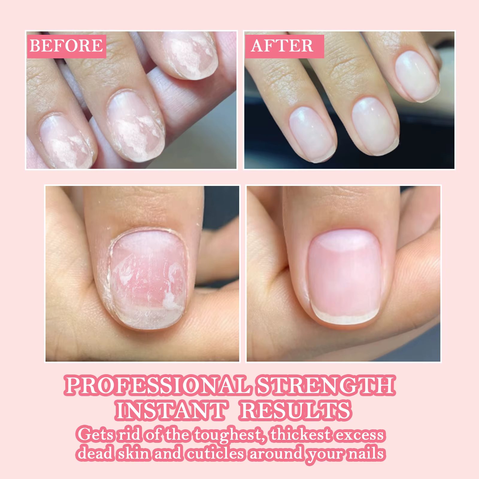 Renforçateur d'ongles puissant 12/20 ml