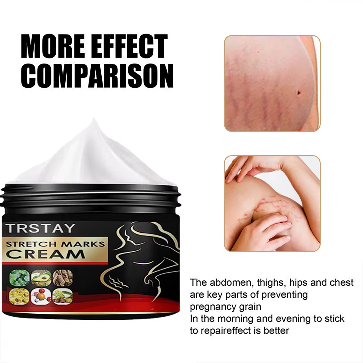 TRSTAY crème contre les vergetures pour la peau de grossesse reconstituer et réparer la Promotion de la croissance cellulaire soins de maternité Striae Gravidarum