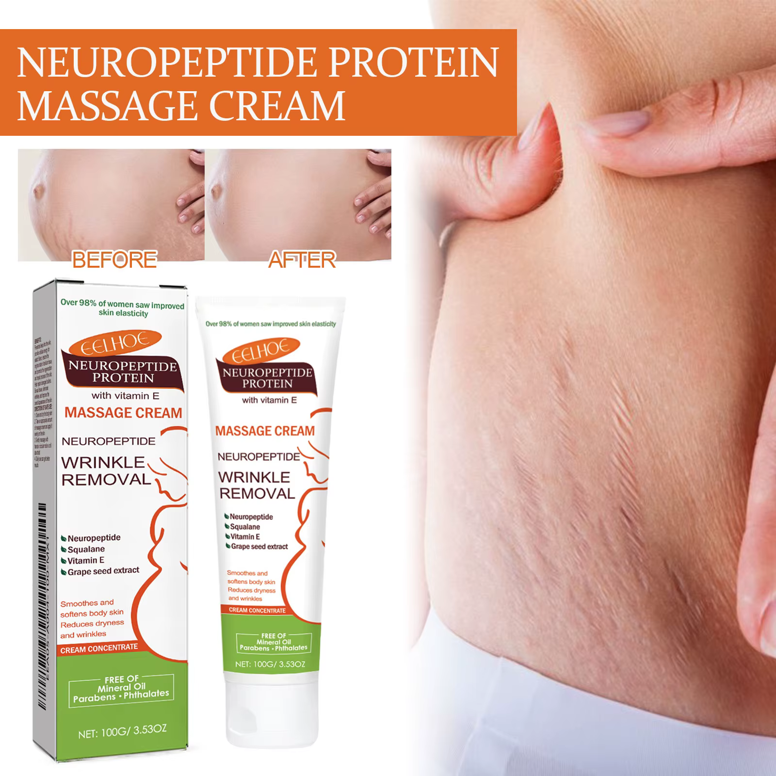 Crème anti-vergetures permanente 100g pour femmes enceintes, soin corporel lissant, réparateur et raffermissant pour la peau