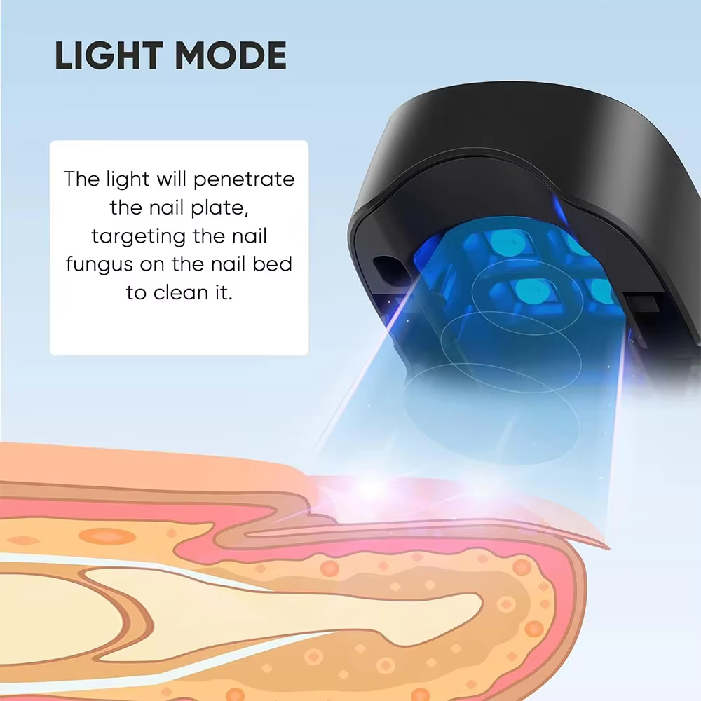 Appareil laser LED pour le traitement des champignons des ongles