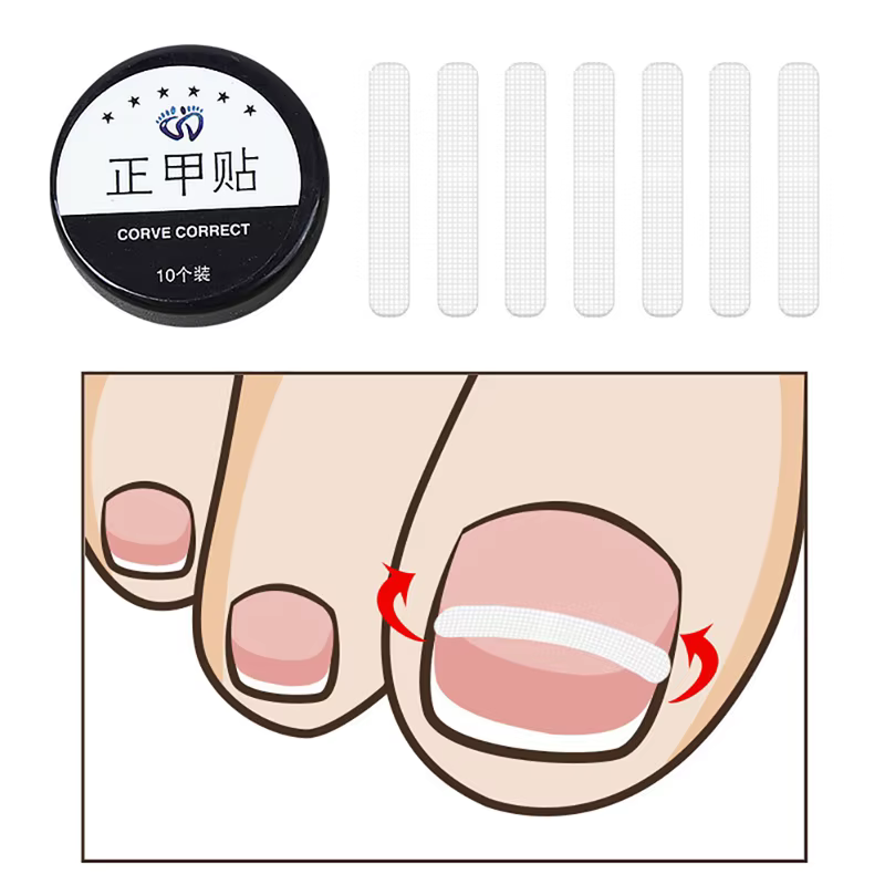 Traitement des ongles incarnés
