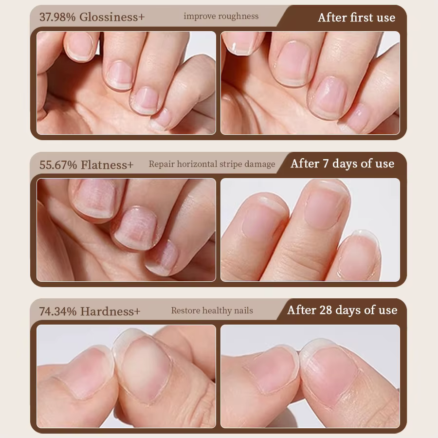 RSNAIL Stylo à huile pour cuticules 3 en 1 avec poussoir à ongles en céramique