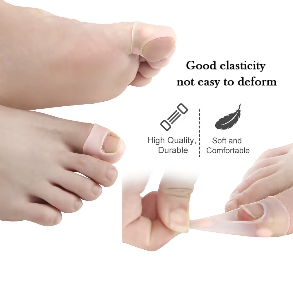 Pexmen 2/4/10 pièces Gel correcteur d'ongle incarné manches gros orteil ongles guérison soins protecteurs Paronychia traitement pédicure outil