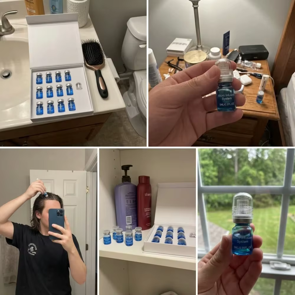 Kit de soins capillaires à micro-aiguilles pour usage domestique, contenant un sérum nutritif, formule douce pour l'entretien quotidien du cuir chevelu