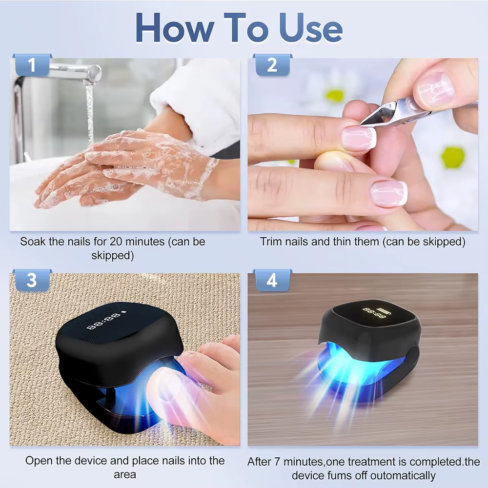 Dispositif Laser fongique pour réparation des ongles des pieds