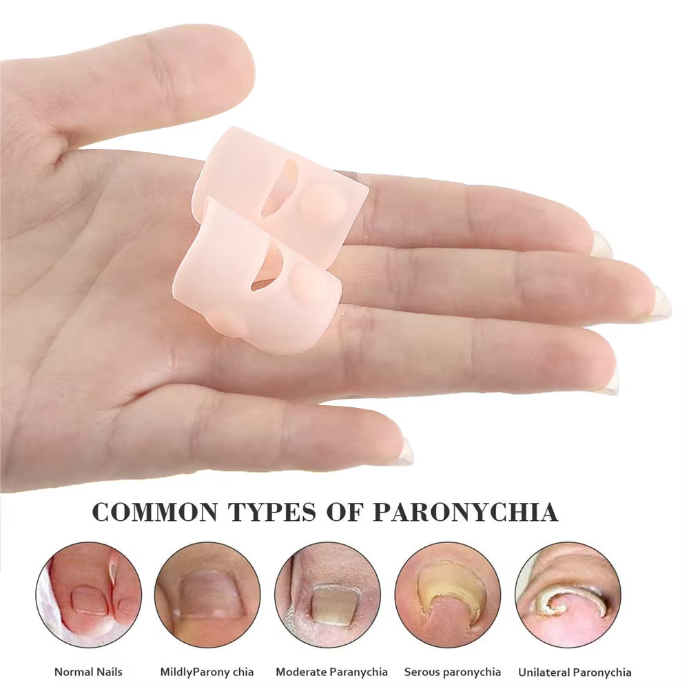 Pexmen 2/4/10 pièces Gel correcteur d'ongle incarné manches gros orteil ongles guérison soins protecteurs Paronychia traitement pédicure outil
