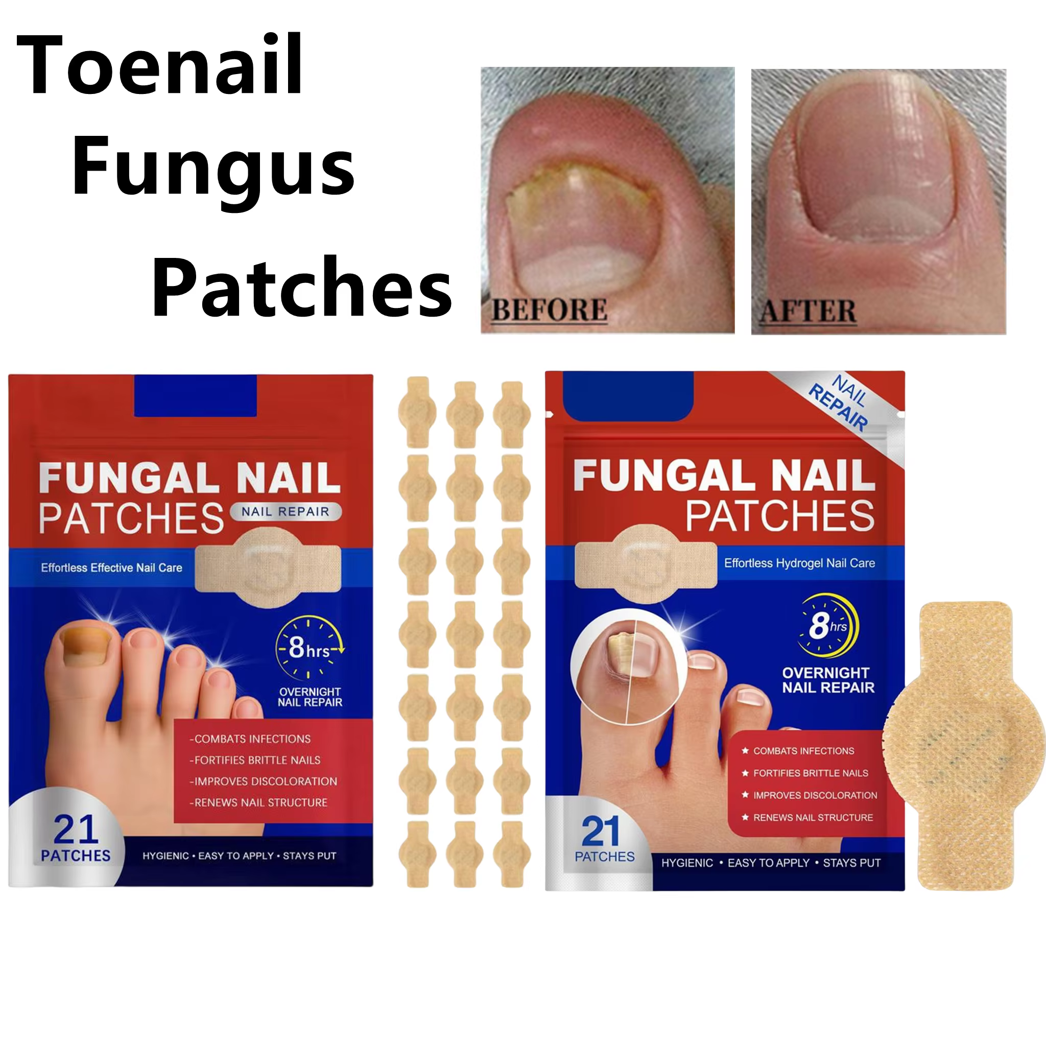 Patchs imperméables pour réparation des ongles incarnés