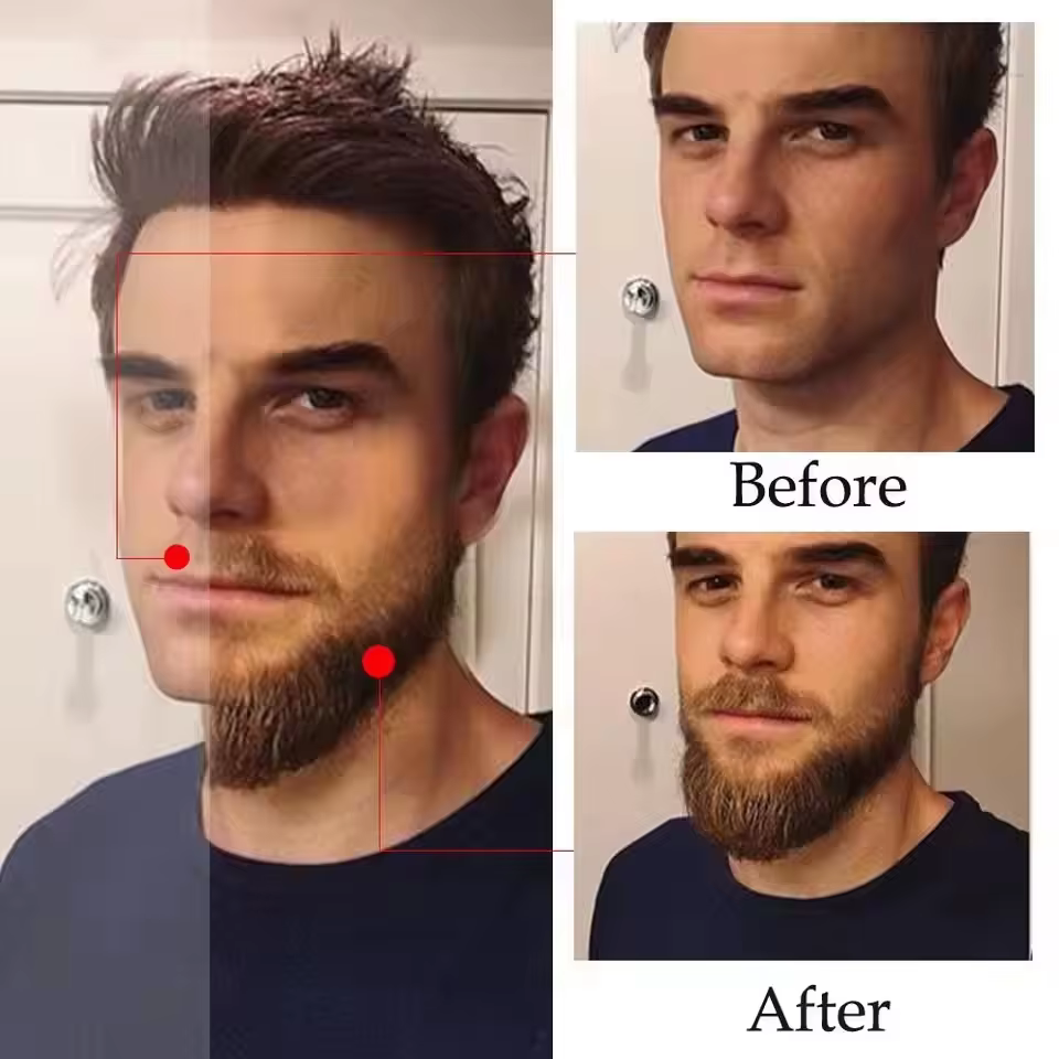 Sérum de croissance rapide de la barbe de haute qualité pour hommes, favorise la repousse de la barbe, plus épaisse, plus longue, plus dense, anti-chute, huile essentielle pour les soins capillaires