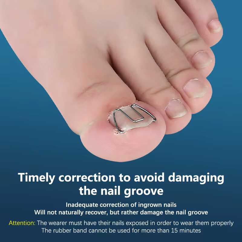 Outil de traitement des ongles incarnés