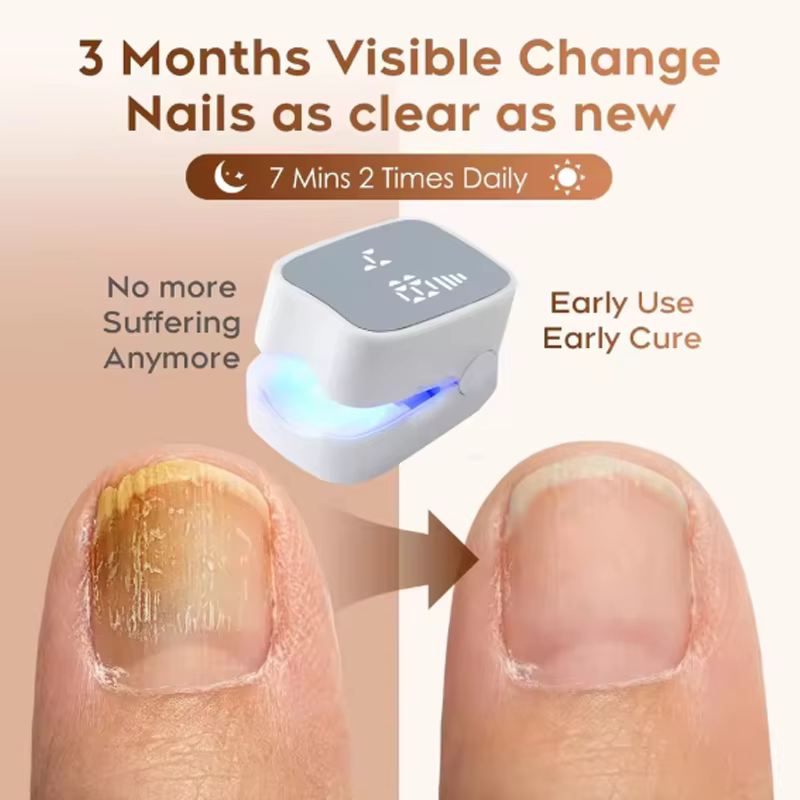 Appareil de thérapie laser pour le nettoyage des ongles