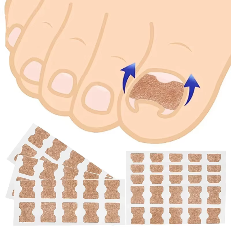 Ensemble de Correction des ongles incarnés