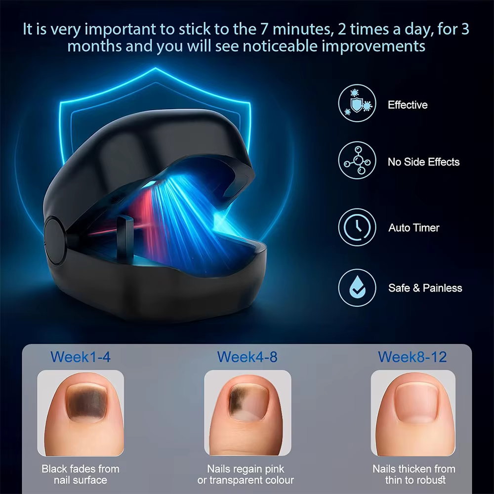 Dispositif de traitement au Laser pour champignons des ongles