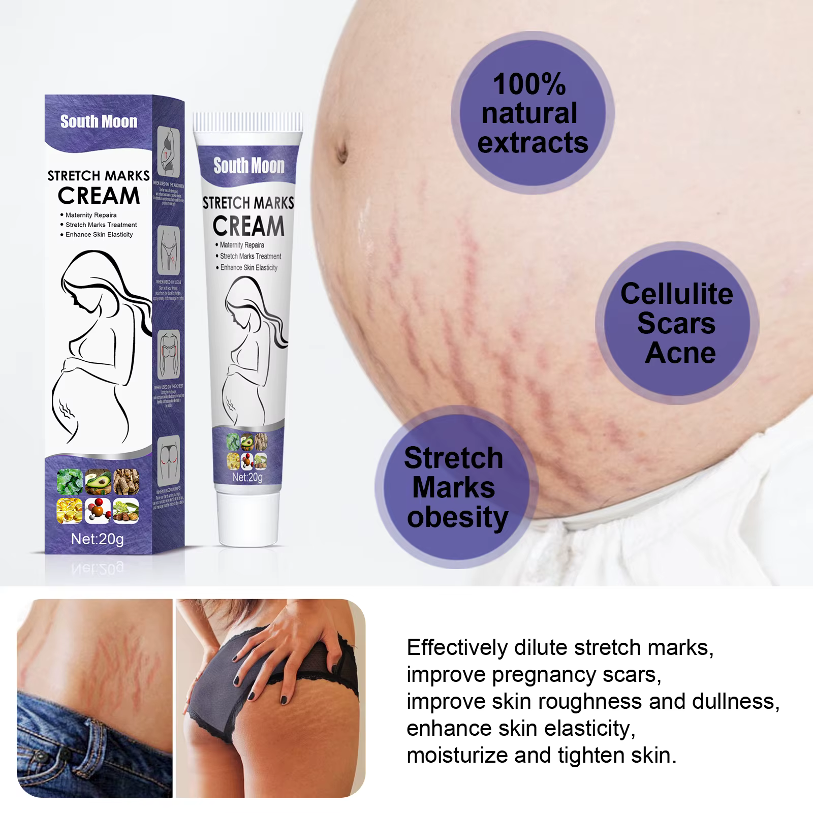 Crème anti-vergetures de grossesse, améliore l'élasticité, estompe les lignes de croissance, lissante, nourrissante, hydratante, raffermissante, soins pour la peau