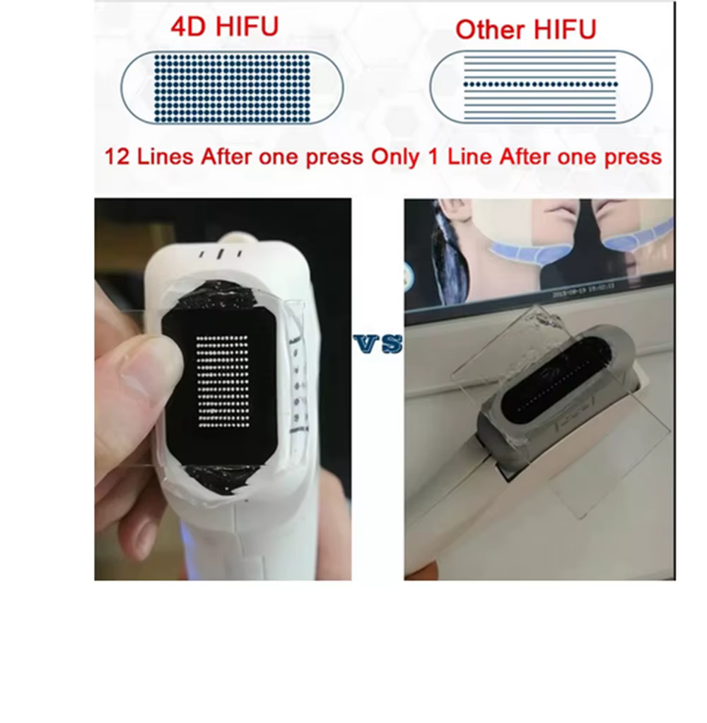 Cartouches HIFU 3D/4D, 20000 coups, 12 lignes, tête de remplacement pour Anti-rides, Lifting du visage et du corps, Machine HIFU