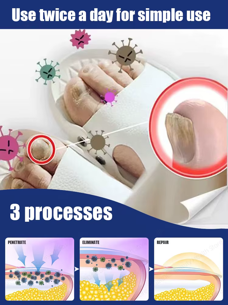 L'éclairage bleu de haute qualité pour les ongles favorise