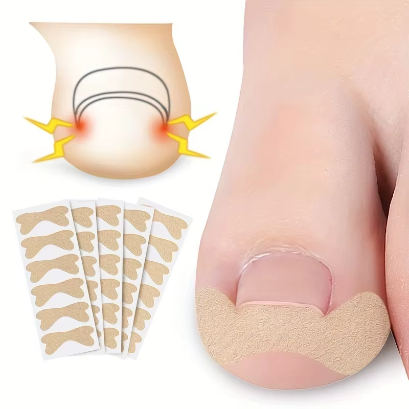 Patch Ortho pour Ongles Incarnés