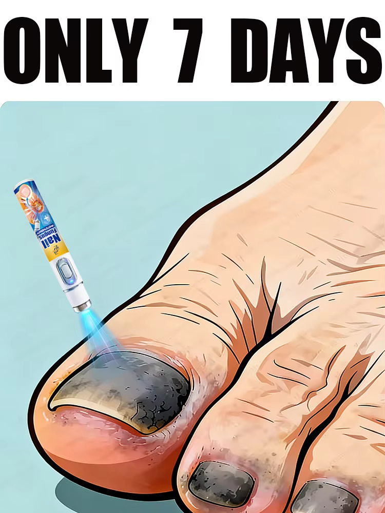 Stylo laser de traitement des mycoses des ongles